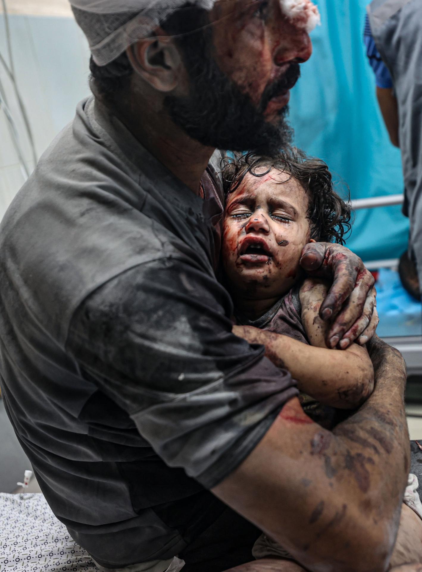 New York Photography Awards Winner - The Israeli-Palestinian conflict