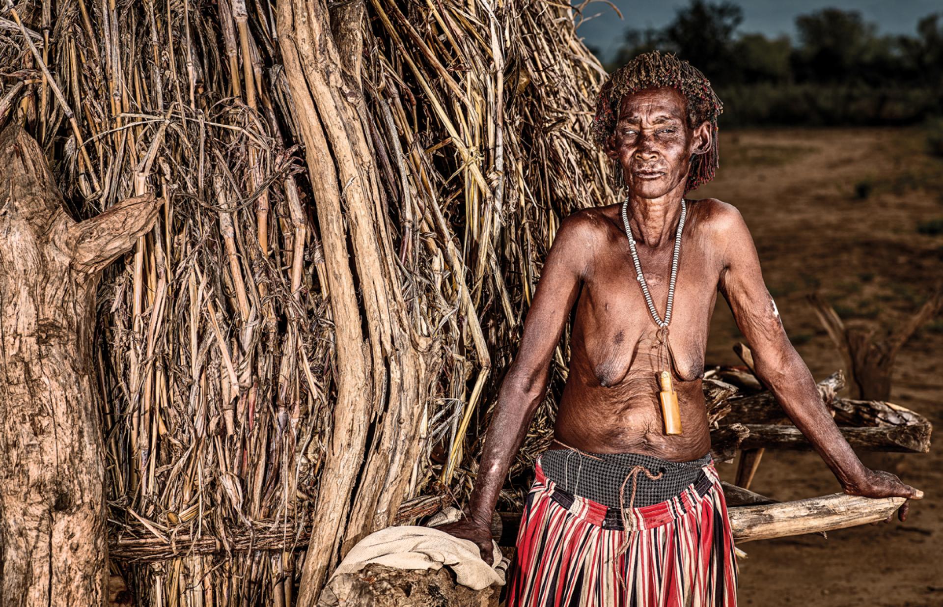 New York Photography Awards Winner - Nearly Blind