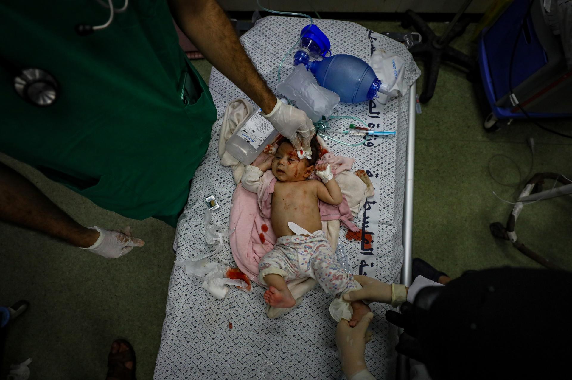 New York Photography Awards Winner - Gaza: The Face of Humanity Under the Weight of Genocide and 